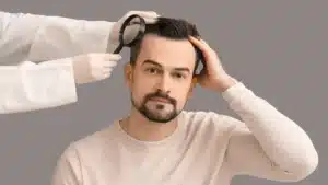 Hair Transplant Risks & How to Avoid Them